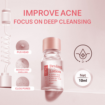 🔥40 % rabatt så länge lagret räcker!🎉Salicylsyra mot akne – torr pulverspray